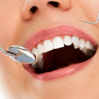 Кейс MediaNation: в 15 раз снизили стоимость лида в VK Рекламе для стоматологической клиники