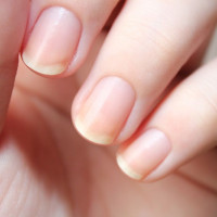 Как отрастить длинные крепкие ногти за 100 дней?