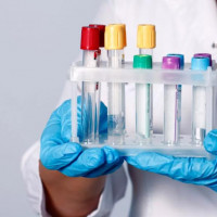 Химико- токсилогические исследования наркологические вещества для водителей⁠⁠