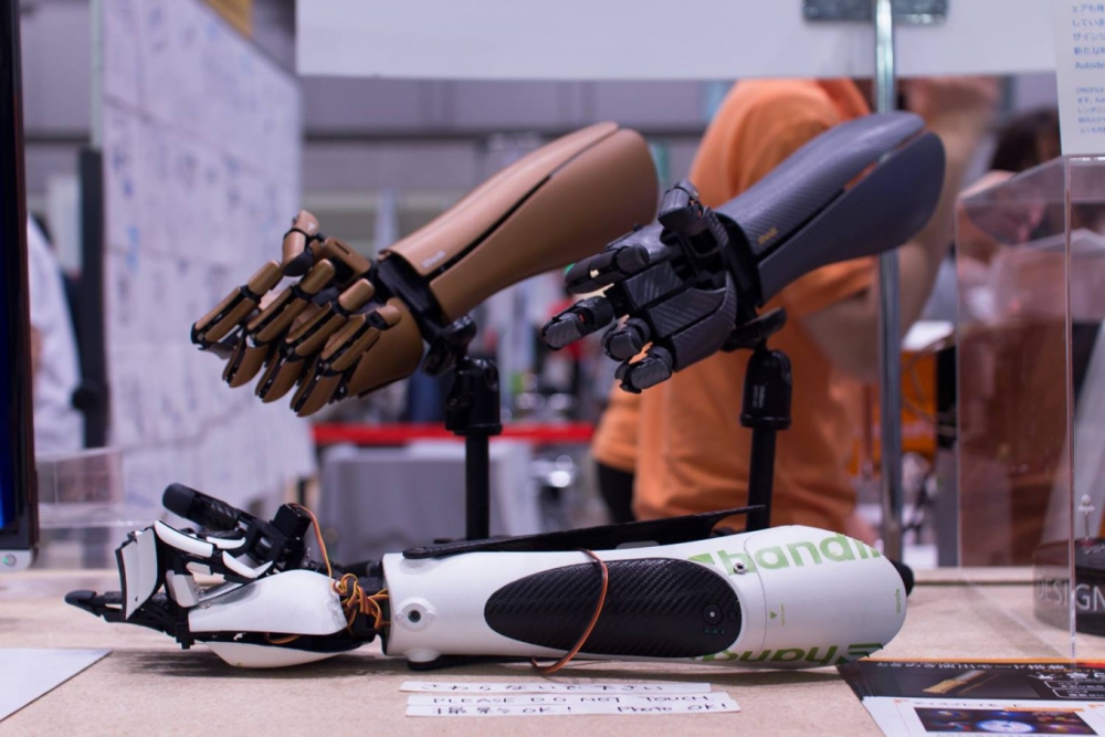 Новые технологии протезирования. Бионическая нога. Бионический протез ноги. Протезы современные технологии.