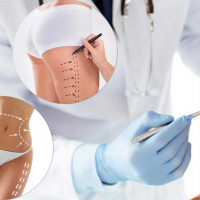 Как эффективно повысить продажи в пластической хирургии