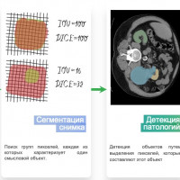 VisionLabs займется разработкой ИИ-решений для медицины