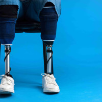 Ученые Пермского Политеха разработали инновационный метод упрочнения 3D-печатных элементов экзопротезов