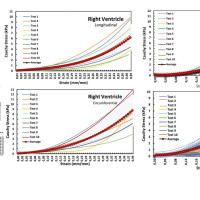 Ученые из ЮАР и Пермского Политеха провели исследования по изучению механических свойств миокарда