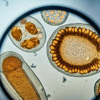 Петербуржцы активно скупают лекарства от паразитов: Ютека зафиксировала скачок продаж на 17%